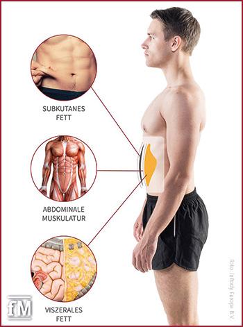 Viszerales Fett ist das Fett, das in der freien Bauchhöhle um lebenswichtige Organe eingelagerte wird
